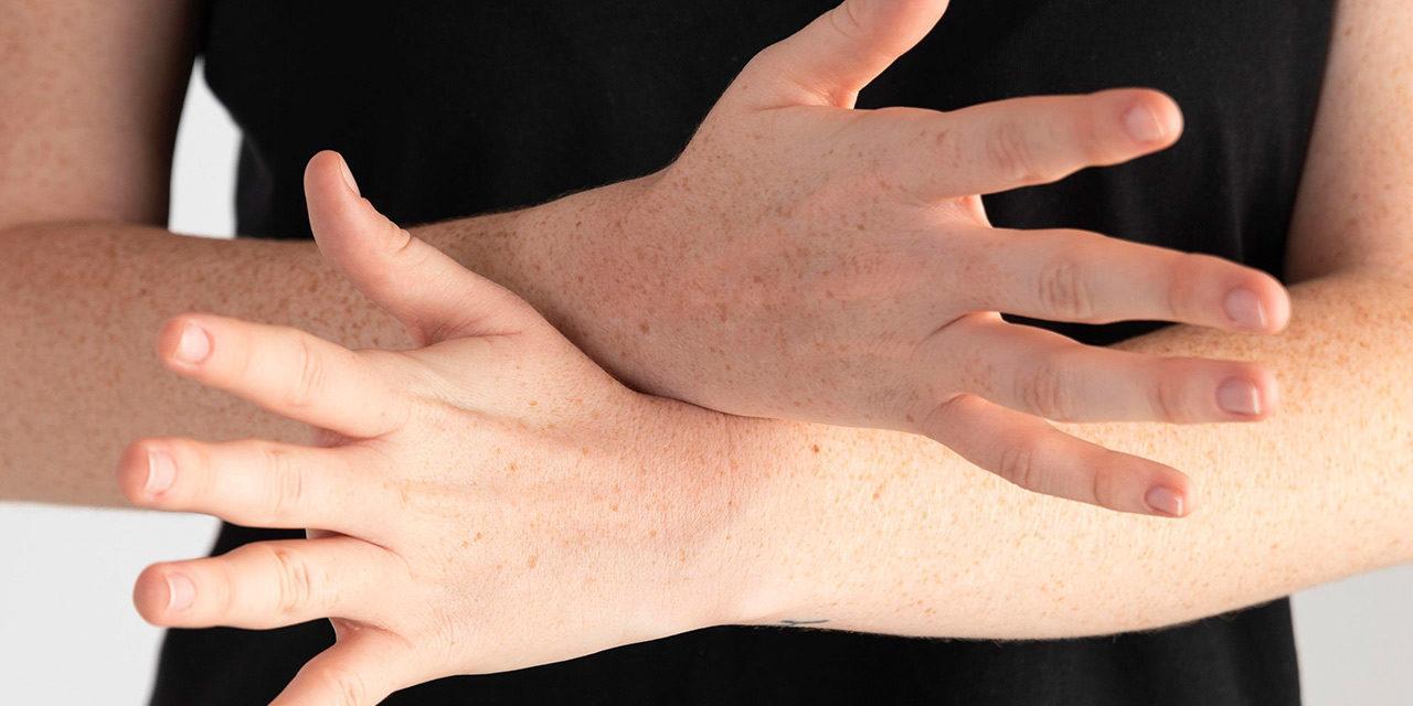 Fingerarthrose – Ursachen, Symptome und Behandlung