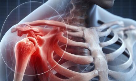 ACG-Arthrose: Leitfaden zur Schlüsselbein-Gelenkserkrankung und deren Behandlung 