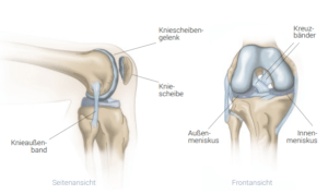 Knie Arthrose - Ursache, Symptome und Behandlung