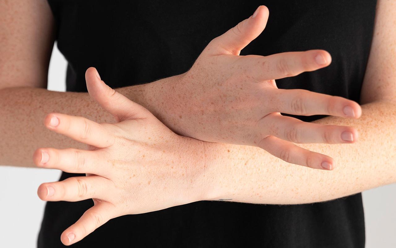 arthrose-im-finger-ursachen-symptome-und-behandlung-arthroseportal